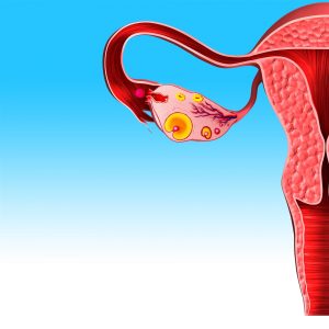 LBGT surrogacy arrangements